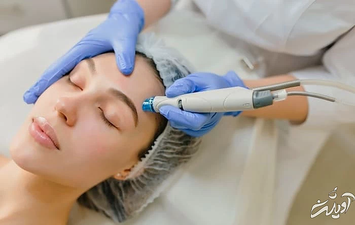 فیشیال صورت